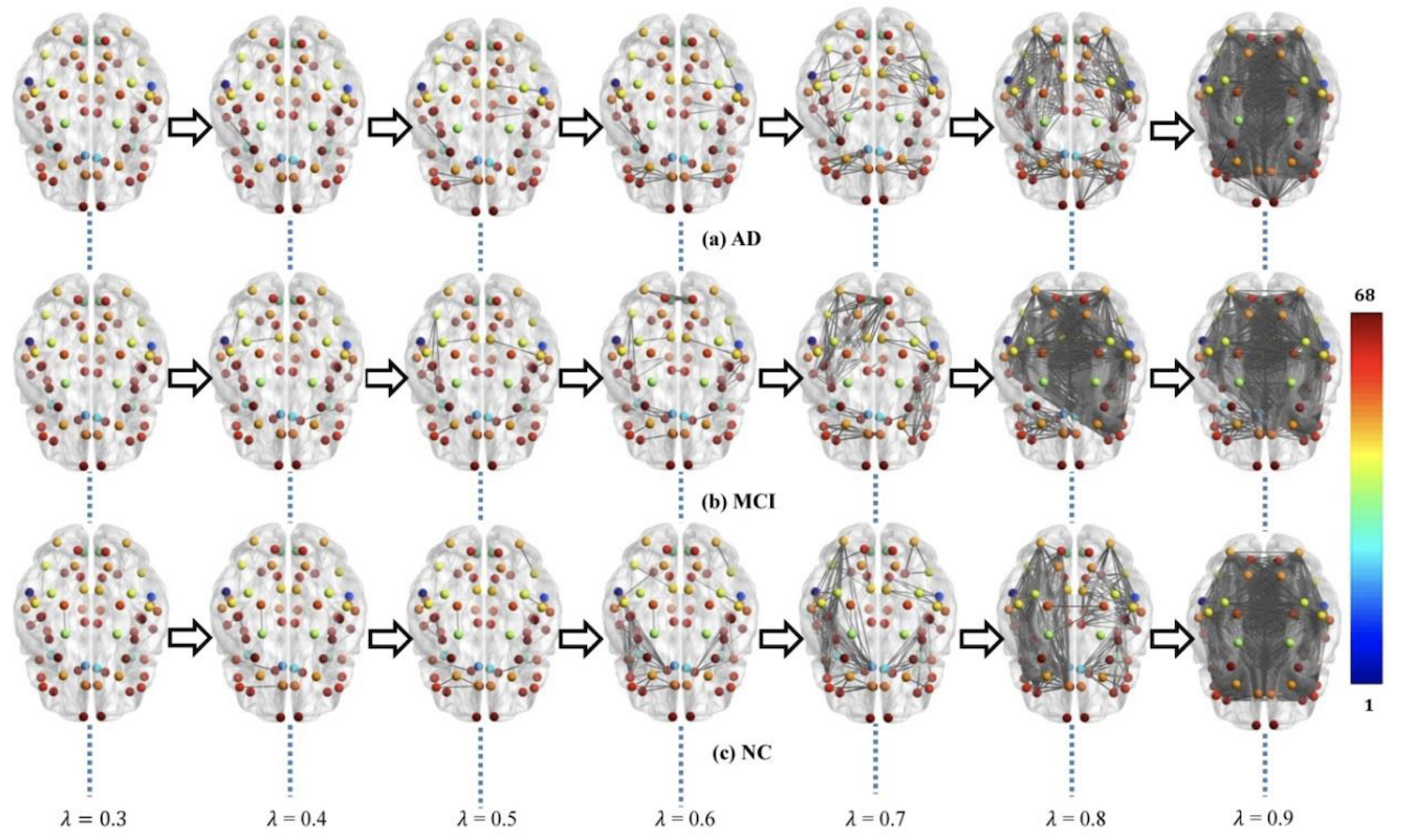 Figure Brain